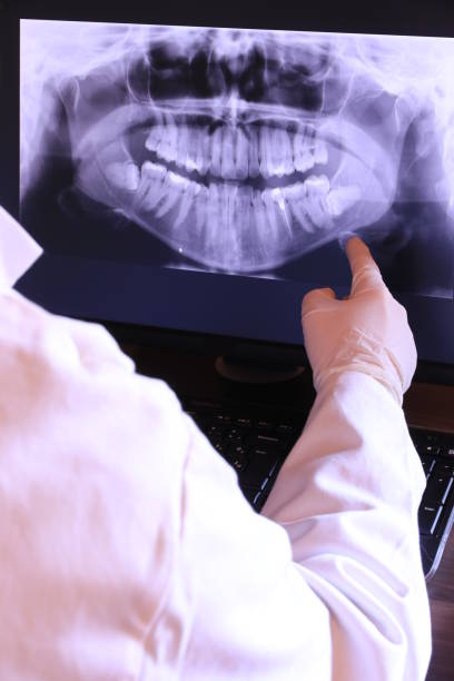 Best Emergency Root Canal Treatment in Worthington Hills, KY