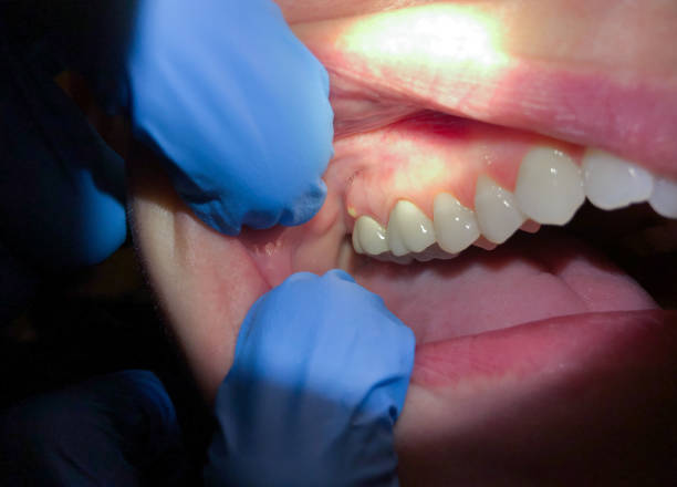Reliable KY Emergency Dentist Solutions