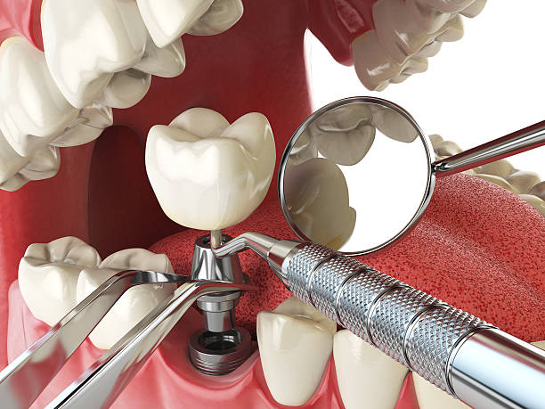 Best Emergency Dental Surgery in Worthington Hills, KY